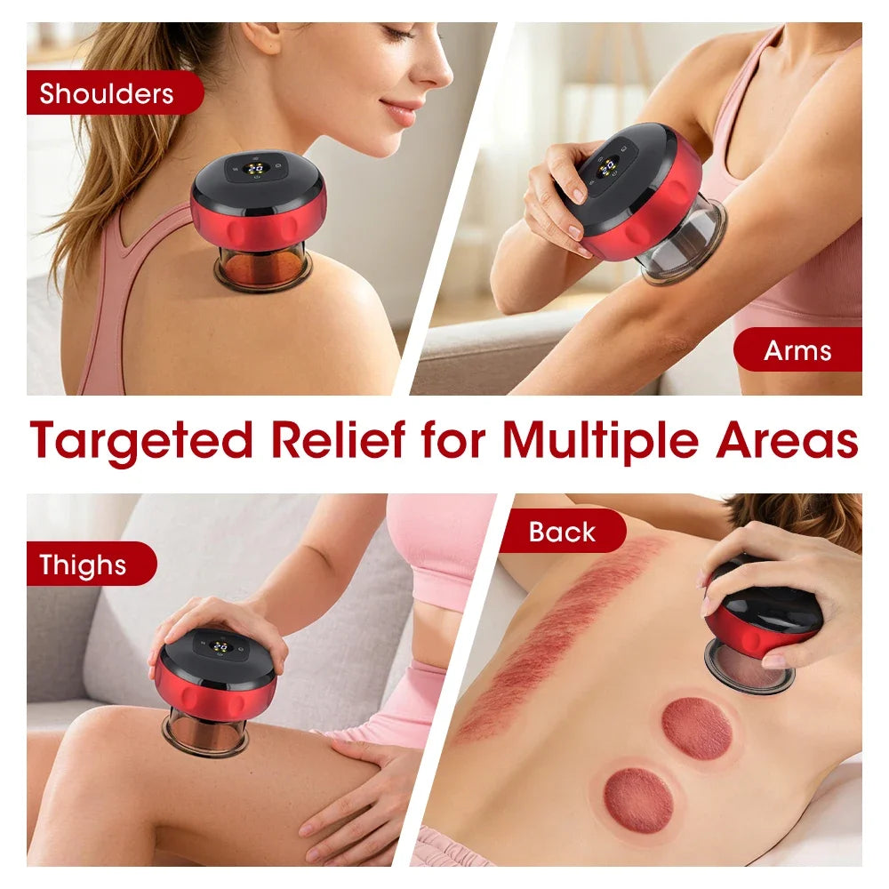 Smart Electric Cupping Massager — Red Light Heat Therapy, 12-Level Suction