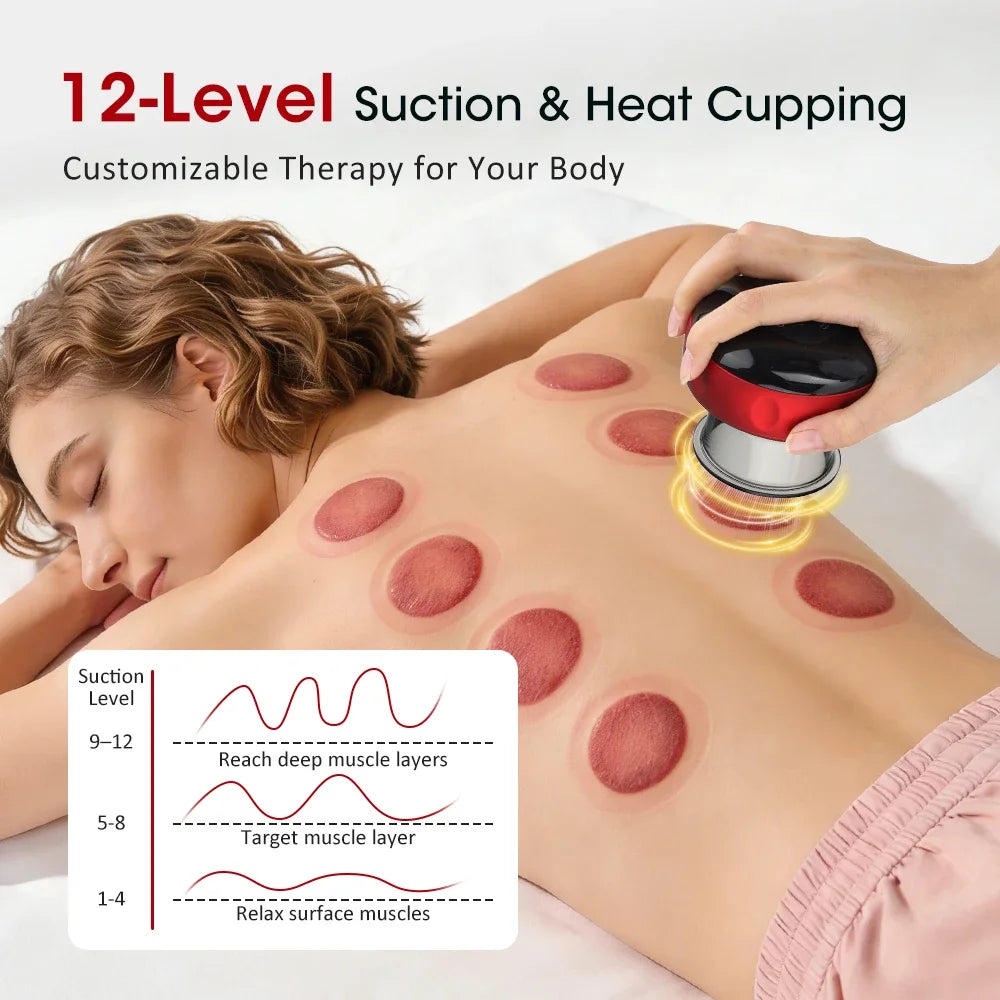 Smart Electric Cupping Massager — Red Light Heat Therapy, 12-Level Suction
