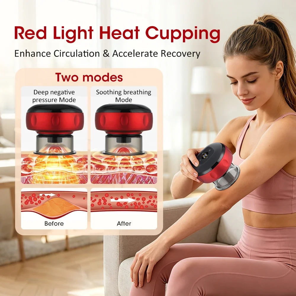 Smart Electric Cupping Massager — Red Light Heat Therapy, 12-Level Suction