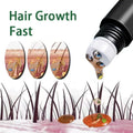 Biotin Fast Hair Growth Oil Products Care Scalp Massage Treatments Anti Hair Loss Effective Grow Thicker Hair Serum for Men